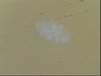 Testechiniscus laterculus image