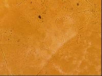 Testechiniscus laterculus image