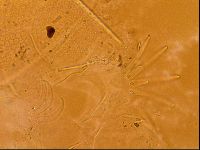 Testechiniscus laterculus image