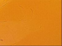 Testechiniscus laterculus image