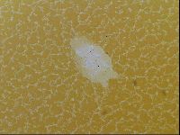 Testechiniscus laterculus image