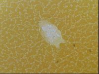 Testechiniscus laterculus image