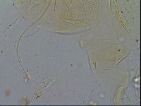 Testechiniscus laterculus image
