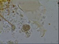 Testechiniscus laterculus image