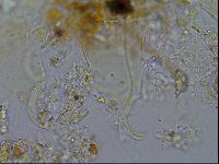 Testechiniscus laterculus image