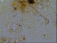 Testechiniscus laterculus image
