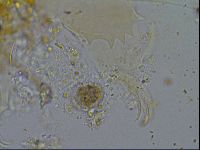 Testechiniscus laterculus image