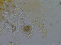 Testechiniscus laterculus image