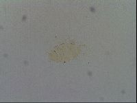 Testechiniscus laterculus image