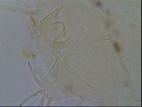 Testechiniscus laterculus image