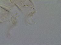 Testechiniscus laterculus image