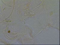 Testechiniscus laterculus image