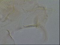 Testechiniscus laterculus image