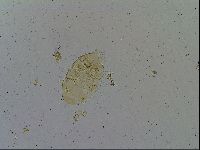Testechiniscus laterculus image