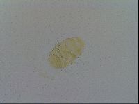 Testechiniscus laterculus image