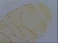 Testechiniscus laterculus image