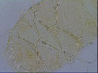 Testechiniscus laterculus image