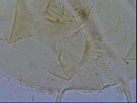 Testechiniscus laterculus image