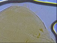 Testechiniscus laterculus image