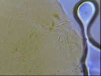 Testechiniscus laterculus image