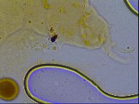 Testechiniscus laterculus image