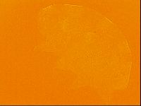 Testechiniscus laterculus image