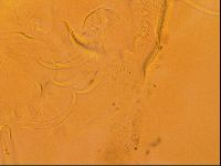 Testechiniscus laterculus image