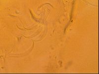 Testechiniscus laterculus image