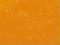 Testechiniscus laterculus image