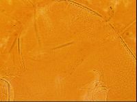 Testechiniscus laterculus image