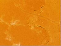 Testechiniscus laterculus image