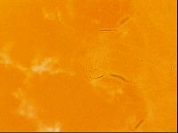 Testechiniscus laterculus image