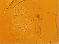 Testechiniscus laterculus image