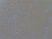 Testechiniscus laterculus image
