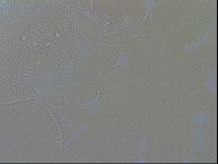 Testechiniscus laterculus image
