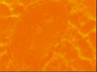 Testechiniscus laterculus image