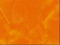 Testechiniscus laterculus image