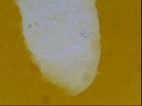 Testechiniscus laterculus image
