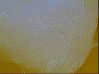 Testechiniscus laterculus image