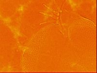 Testechiniscus laterculus image