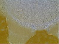 Testechiniscus laterculus image