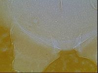 Testechiniscus laterculus image
