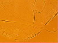 Testechiniscus laterculus image