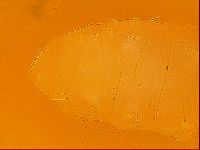 Testechiniscus laterculus image