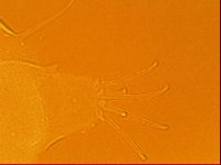 Testechiniscus laterculus image