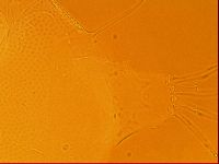 Testechiniscus laterculus image