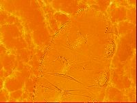 Testechiniscus laterculus image