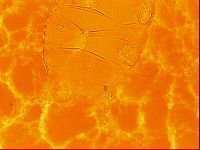 Testechiniscus laterculus image