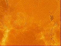 Testechiniscus laterculus image
