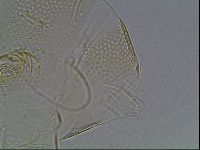 Testechiniscus laterculus image